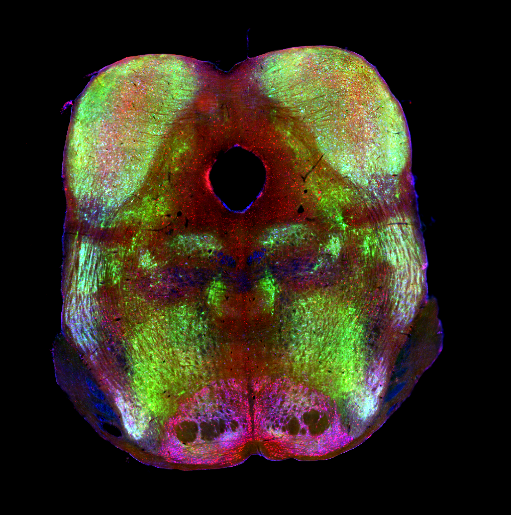 A stitched coronal brainstem section in false-colour triple fluorescence — DAPI (blue), FITC (green) and Rhodamine (red/magenta) — assembled seamlessly from hundreds of microscope tiles with no visible seams